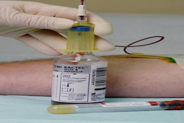 Blood Culture Collection
