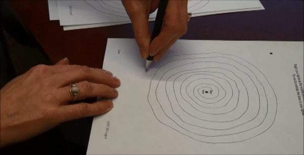 Essential tremor