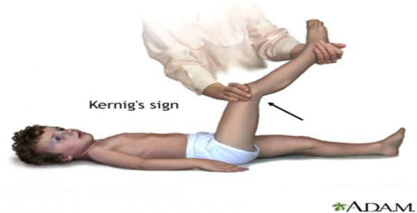 Kernig's Test