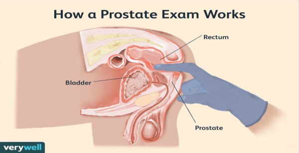 Prostate Examination