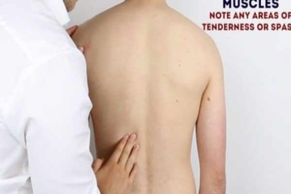 Spine Examination