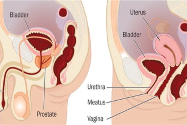 Urinary catheterization in men and women
