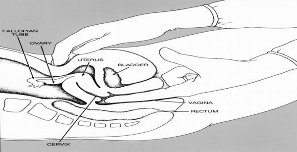 bimanual vaginal examination