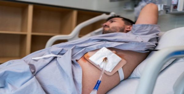 chest tube insertion (2) chest tube insertion (2)