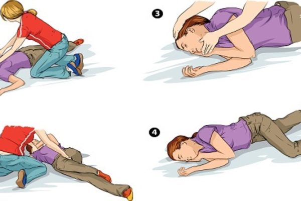 seizure first aid